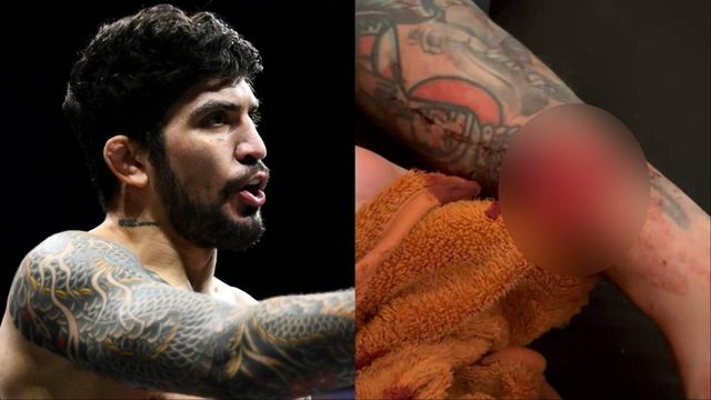 Dillon Danis